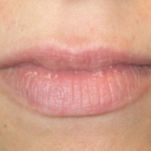 lip needle shaping